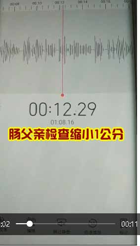 肠部位的父亲用蟾衣在上海检查缩小1公分多